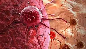 Obat Kanker Alami Stadium 1,2,3,4

